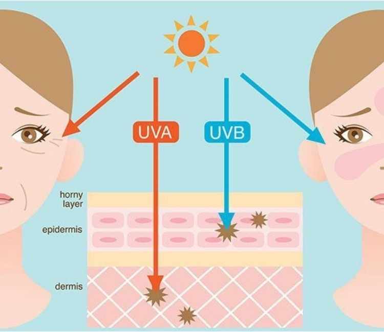 Bahaya Paparan Sinar Uv Berlebih Bagi Kulit Ancaman Tersembunyi Di Bawah Matahari